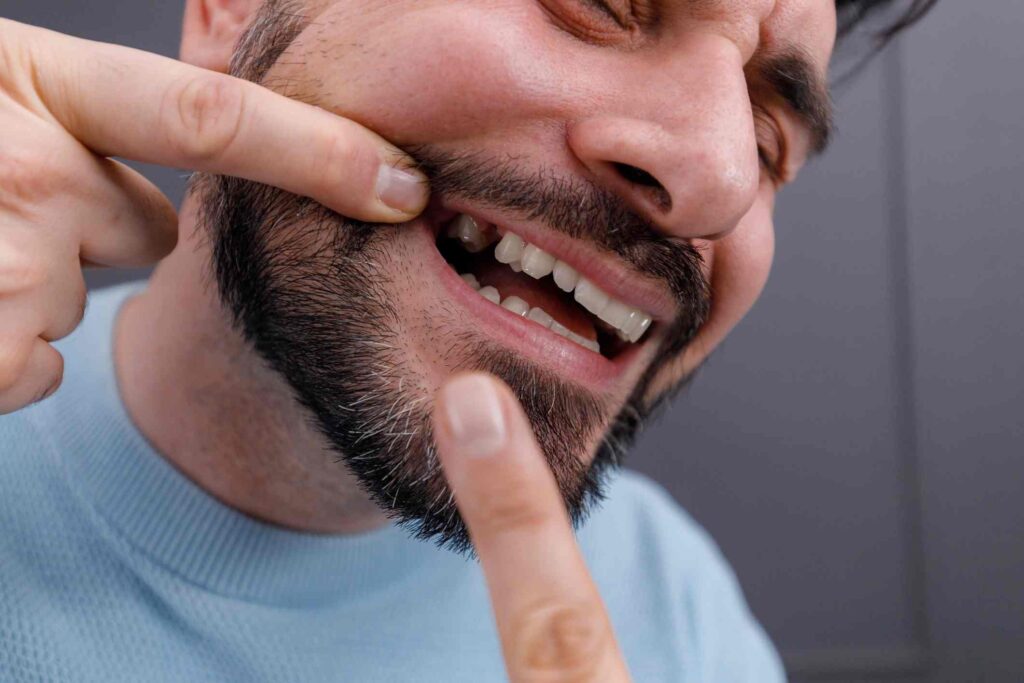 Person pointing at a missing upper tooth, highlighting dental restoration needs in Creve Coeur, MO